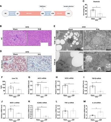 The Role of Gut Microbiota in Duodenal-Jejunal Bypass Surgery-Induced Improvement of Hepatic Steatosis in HFD-Fed Rats